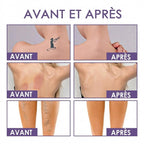 Correcteur Corps