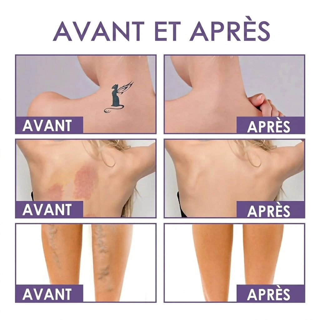 Correcteur Corps